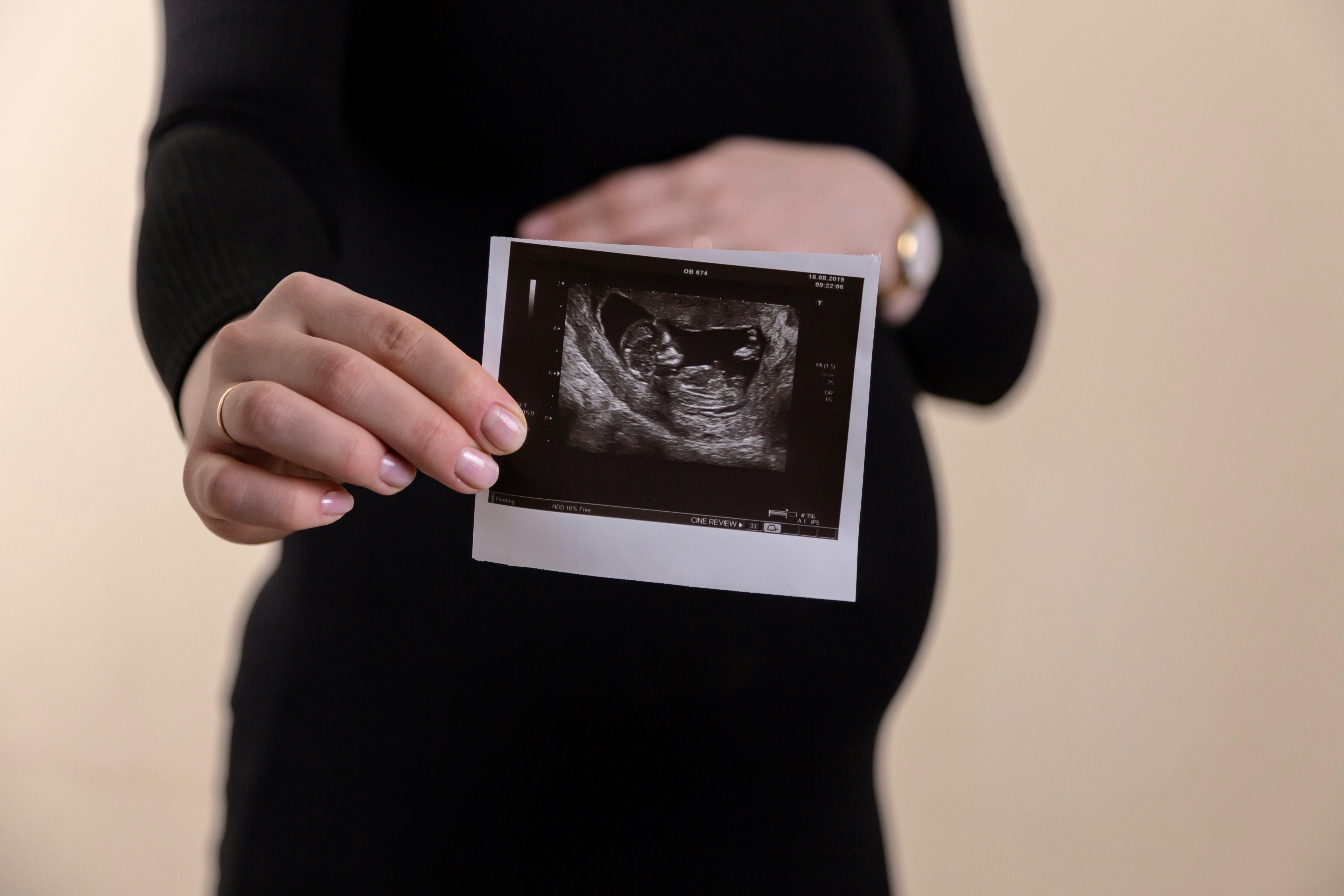 Post-Abortion Follow-up Care